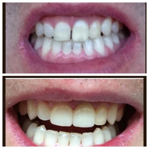 Smile4
